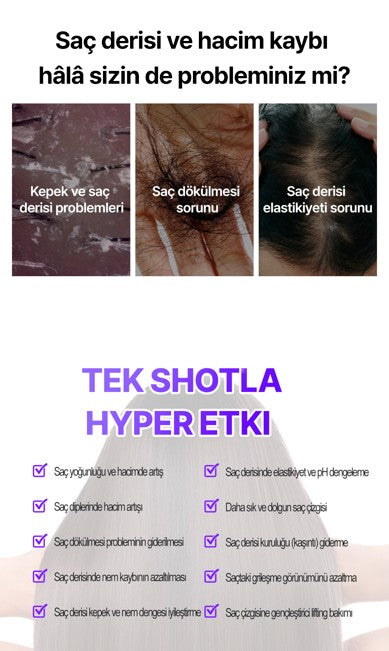Hyper Shot (Günbatımı Pembe / Bulutlu Bej)
