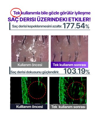 Hyper Shot (Günbatımı Pembe / Bulutlu Bej)