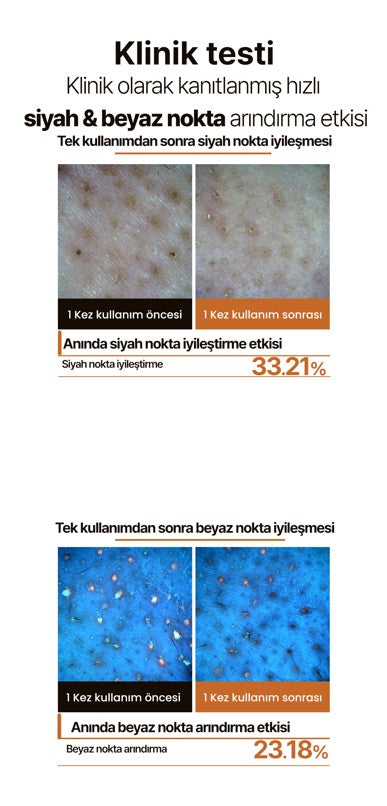 Resnovae Cleansing Powder – Derinlemesine Arındırıcı Toz Temizleyici